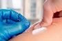 Dry needling IMS therapy for muscular pain relief Dry needling IMS therapy for muscular pain relief