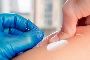IMS/Dry Needling – Feel Better, Move Better