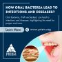 How Oral Bacteria Lead to Infections and Diseases?