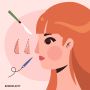 Transform Your Look with Expert Rhinoplasty in Ahmedabad