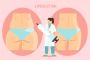 Tummy Tuck Surgery in Ahmedabad