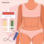 Liposuction Surgery Ahmedabad