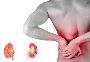 Kidney Stone Treatment 