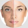 Skin Whitening Treatment in Punjab