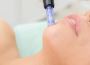 Microneedling Texas