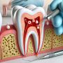 Restore Your Smile with Expert Bone Grafting in Glastonbury,