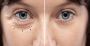 Best Oculoplasty Treatment in Mumbai			