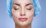 Face Lift Surgery Procedure in Delhi