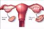 Comprehensive PCOD Treatment Clinic in Ahmedabad for Long-Te