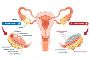 Expert Menopause Care at the Best Menopause Clinic in Ahmeda