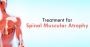 Spinal Muscular Atrophy Treatment By Chiropractor