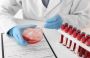 Affordable CBC Test in Delhi at Redcliffe Labs