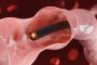 Looking for the Best Endoscopy Center in Redding