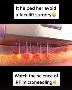 Transform Your Skin with AGNES RF Microneedling