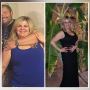 Post-Weight Loss Skin Tightening: Restore Your Confidence