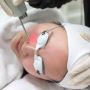Transform Your Skin with Advanced Laser Treatments