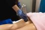 Smooth Away Cellulite with Renewed Medical Health and Beauty