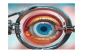 Advanced Oculoplasty Eye Treatment in Indore