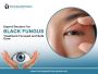 Save Your Eyes from Black Fungus 