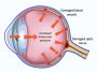 Trusted Glaucoma Specialists in Dubai for Eye Care
