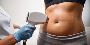 Is Laser Tattoo Removal in Brentwood the Best Solution for U