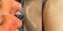 What is a scar camouflage tattoo and how does it work?