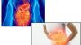 Top Gastro Surgeon in Jaipur – Safe & Effective Procedures
