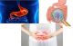 Trusted Bariatric Surgeon in Jaipur – Safe & Effective Weigh
