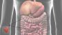 Best Gastrointestinal Surgeons in Jaipur
