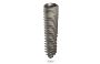 Spiral SB/LA Implants - Titan Dental Implant
