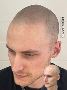 Revitalize Your Look with Hair Pigmentation