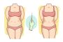 Liposuction surgery in Mumbai | Restore Clinic