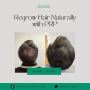 Regrow Hair Naturally with PRP