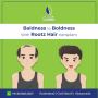 Hair Tranaplant Clinic in Hyderabad - Rootz Hair
