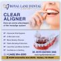 Clear Aligners in Dallas