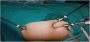 Best Doctor for Gallbladder Stone Surgery in Kolkata
