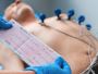Affordable ECG Test Price in Delhi | R.S. Tomer