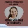 Ruparelia Dental Clinic offers permanent smile solutions