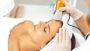 Laser Skin Tightening Islamabad