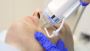 Rejuvenate Your Skin with RF Microneedling in Las Vegas!