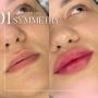 Enhance Your Confidence with Lip Augmentation at Safi Miran 