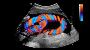 How Ultrasound Works