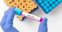Restore Health with Stem Cell Therapy in NYC