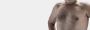 Gynecomastia Surgery in Delhi - SB Aesthetics Clinic