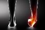 5 Common Mistakes in Sprained Ankle Treatment