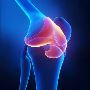 5 Measures of knee surgery singapore  