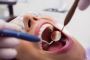 Experienced Root Canal Dentists at Your Service!