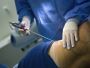 Top 3 Plastic Surgery Procedures Men