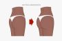 Enhance Curves with Buttock Augmentation Surgery