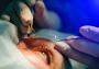 Who is the Best Cornea Specialist in Delhi?